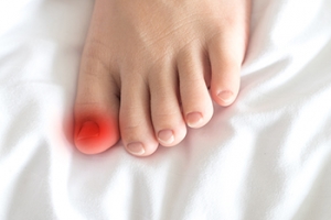 How Do Ingrown Toenails Develop?