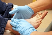 Simple Methods for Proper Diabetic Foot Care